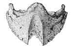 OS PEDIS SHOWING THE GROOVE IN IT CAUSED BY ATROPHY AND ABSORPTION INDUCED BY PRESSURE OF A KERAPHYLLOCELE.
