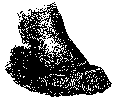 FOOT WITH ADVANCED CANKER.