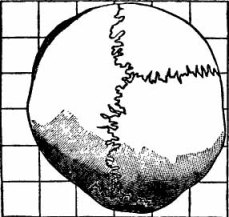 Skull Formation